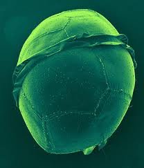 La dinoflagellée Peridinium divergens fait partie du plancton végétal (ou phytoplancton) et a besoin de la lumière pour effectuer la photosynthèse.  JPEG - 8.2 ko