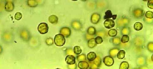 Vue de l'algue minuscule en microscopie électronique.  JPEG - 19.5 ko